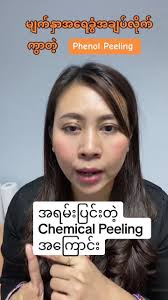 အရမ်းပြင်းတဲ့ Phenol Peeling အကြောင်း