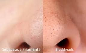 Namun kesannya hanya untuk hasil yang sementara kerana ia mensasarkan pigmen. Beauty Journal Situs Kecantikan Dan Gaya Hidup Andalan Wanita Masa Kini