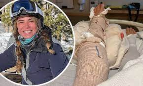 Luciana Gimenez, 53, shares hospital snaps of her cast after ...