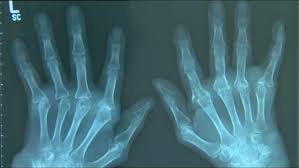 Maybe you would like to learn more about one of these? Ø§Ù„Ù€Ø±ÙˆÙ…Ù€Ø§ØªÙ€ÙŠÙ€Ø²Ù… Ø­Ù€Ù‚Ù€Ø§Ø¦Ù€Ù‚ ÙˆØ£ÙˆÙ‡Ù€Ù€Ù€Ù€Ø§Ù… Ù…Ù†ÙˆØ¹Ø§Øª Ù†Ø§ÙØ°Ø© Dw Ø¹Ø±Ø¨ÙŠØ© Ø¹Ù„Ù‰ Ø­ÙŠØ§Ø© Ø§Ù„Ù…Ø´Ø§Ù‡ÙŠØ± ÙˆØ§Ù„Ø£Ø­Ø¯Ø§Ø« Ø§Ù„Ø·Ø±ÙŠÙØ© Dw 13 10 2014