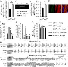Frontiers | Severe Cardiac Toxicity Induced By Cancer Therapies Requiring  Intensive Care Unit Admission