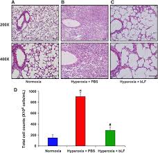 The respiratory systemsections of the larynx, trachea and lung. Aerosolized Bovine Lactoferrin Reduces Lung Injury And Fibrosis In Mice Exposed To Hyperoxia Springerlink