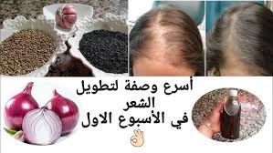 وصفة زريعة او بذور البصل لتنبيت الشعر واعطائه القوة والكتافة والطريقة الصحيحة لاستعماله ومنع تساقطه Youtube