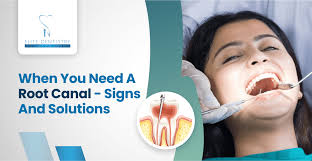 When You Need a Root Canal- Signs and Solutions