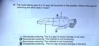 Image result for Decorticate Posturing