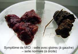 Photo de sang dans les selles. Informations Sur Ibd