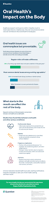 Ranked #7 in best life insurance companies of 2021 (tie) guardian is a great option when choosing an insurance provider because the company offers multiple types of plans including term, whole and. Infographic The Value Of Preventive Dental Care L Guardian