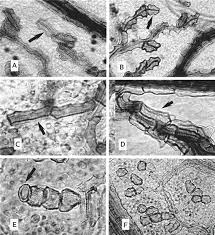 Image result for Alantsilodendron pilosum