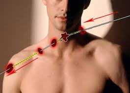 A fost stabilizat din punctul de vedere al funcţiilor vitale şi foarte probabil vom intra în sala de operaţie dimineaţă. Despre Solstitiu Si Traiectoria Soarelui Si Adrian Nastase Si Traiectoria Glontului Urbi Et Orbi