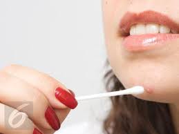 Ikuti 6 Langkah Ini Agar Jerawat Cepat Kering Health Liputan6 Com