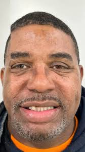 From missing teeth to a brand-new smile in just one day! Our All-on-X  implants gave this patient a fresh start—he’s looking younger, feeling  amazing, and ready to enjoy all his favorite holiday meals. ...