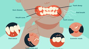 Mouth cancer and other head and neck cancers are often treated similarly. The 9 Most Common Dental Problems