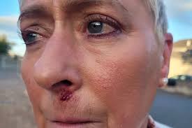 Heartbreak for Gary Cornish after Sam Sexton's injury cancels British title  fight