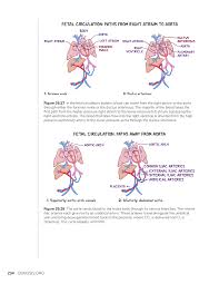 Image result for Delayed Transition from Fetal Circulation