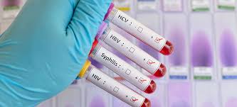 How to use prep in a sentence. Hiv Prep Dr Med Carsten Schwarz