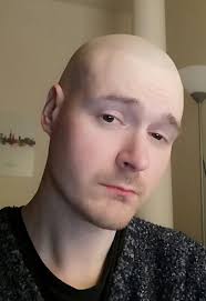 Growing older with a rare disease: time for longevity to lead