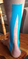 Image result for Taping for Soleus and Achilles