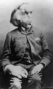 Joseph Merrick Buried In Same Cemetery As Two Of Jack The Rippers Victims Mary Polly Ann Nichols And Catherine Joseph Merrick Human Oddities John Merrick
