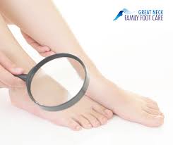 Maybe you would like to learn more about one of these? What Are The Signs Of Diabetic Feet Great Neck Family Foot Care