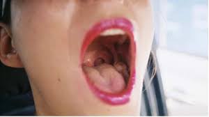 Check spelling or type a new query. What Happens When Oral Gonorrhea Is Left Untreated Sylvastallone
