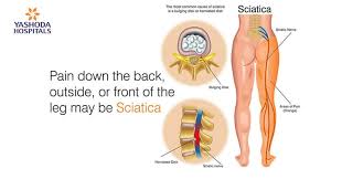 The back considered as an area of vulnerability the police officer's partner always watches his back. Back Pain Due To Bike Riding How Potholes And Bumps On Roads May Cause Back Pain In Youngsters