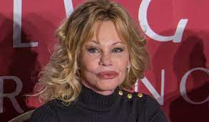 Melanie griffith is not too proud to admit she has some regrets in her life.namely, going overboard with plastic surgery. Melanie Griffith Chose To Fight Time With Anti Aging Treatments And Plastic Surg Melanie Griffith Melanie Griffith Plastic Surgery Cameron Diaz Plastic Surgery