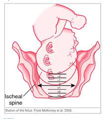 Nursing Success Coaching Institute Jodhpur Station Refers To How Far Down The Baby S Head Has Descended Into The Mother S Pelvis It Is Measured From 5 To 5 The 0 Point Of