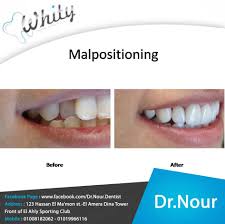 Design Your Smile Your Smile Dental Center Dental