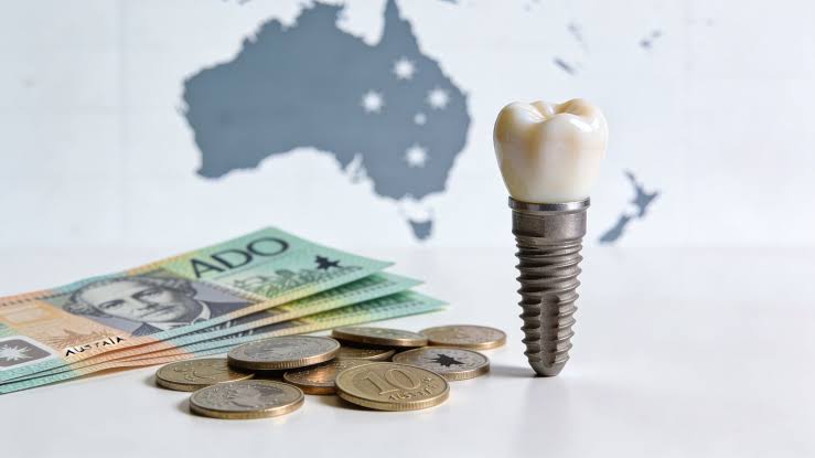 Average Cost of Dental Implants Australia: 2026 Price Guide