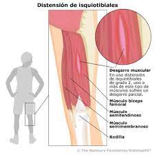 Distension De Isquiotibiales Para Adolecentes Cook Children S
