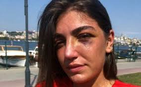 35 yıllık tecrübemizle değerli fikirlerinize sahip çıkıyor, bizi tercih eden 20.000'i aşkın müvekkilimizin haklarını koruyoruz. M7jgrboxquwmlm