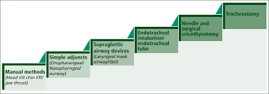 Maybe you would like to learn more about one of these? Airway Management And Endotracheal Intubation By Paramedics For Cardiac Arrest Journal Of Paramedic Practice
