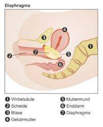 Das verhütungsstäbchen muss von ihrem arzt verschrieben, eingesetzt und auch wieder entfernt werden. Diaphragma Pessar Femidom Diaphragma Co Familienplanung Verhutung Frauenarzte Im Netz Ihr Portal Fur Frauengesundheit Und Frauenheilkunde