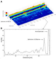 4 years ago hairul dan hanis junior episod 6. Poster Presentations 2020 Neurogastroenterology Amp Motility Wiley Online Library