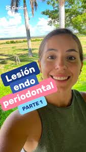 Hablemos de las lesiones endoperiodontales