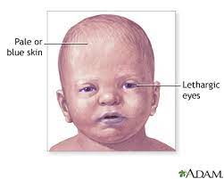 Love Respect Shaken Baby Syndrome A K A Sindrom Goncang Bayi