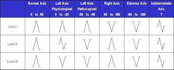 Axis Deviation Reference Ems Ekg Placement Cardiology