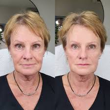 Refine Estetic , Arvika