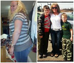 Pin On Befor N After Gastric Sleeve