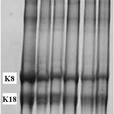 Wool grades are selected to suit the needs of the products being made. Reference Gel Stained With Coomassie Blue W 1 4 100 Wool C 1 4 100 Download Scientific Diagram