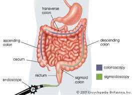 Or to separate groups of numbers. Sigmoidoscopy Medicine Britannica
