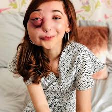 Woman with 'visible difference' has an amazing voice, and Billie Eilish  agrees