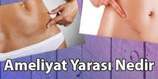 ameliyat yarasi kolajen cil deri