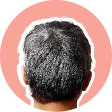 People with insufficient amounts of biotin may have thin hair, hair loss and brittle, thin nails. A Guide To Damaged Hair And 15 Ways To Fix It