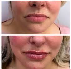 Amara Rejuve Medical...