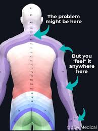 Maintaining this posture creates an angle between your trunk and your legs. How To Know If You Have A Neck Disc Herniation Geelong Osteopaths