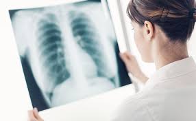 A murit în timpul antrenamentului! Cele Mai Frecvente Boli Bronho Pulmonare Ce Le DeclanÈeazÄ Èi Cum Le RecunoaÈtem Smart Medical