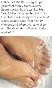 Any feet calluses that you may have had will be gone along with the dead skin that sheds off. Remove Dead Skin From Feet In 10 Minutes This Works I M Going To Do It At Least Once A Week Beauty Skin Diy Pedicure Health And Beauty Tips