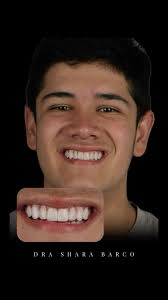 Él es Juan. 🙌🏼 Después de terminar su proceso de ortodoncia, decidió dar  el siguiente paso: un diseño de sonrisa en lentes cerámicos para lograr un  acabado más estético, natural y totalmente ...