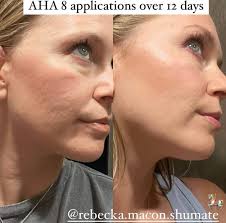 This review BLEW ME AWAY. "Only been using our AHA